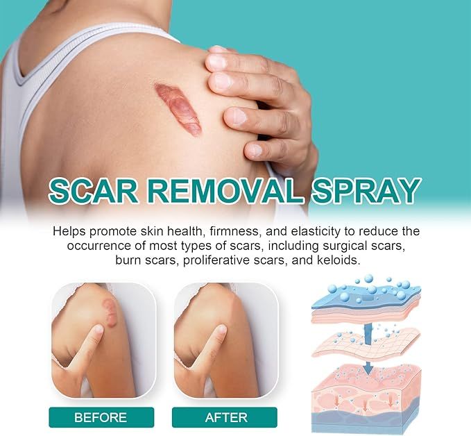 Medical Scar Removal Spray